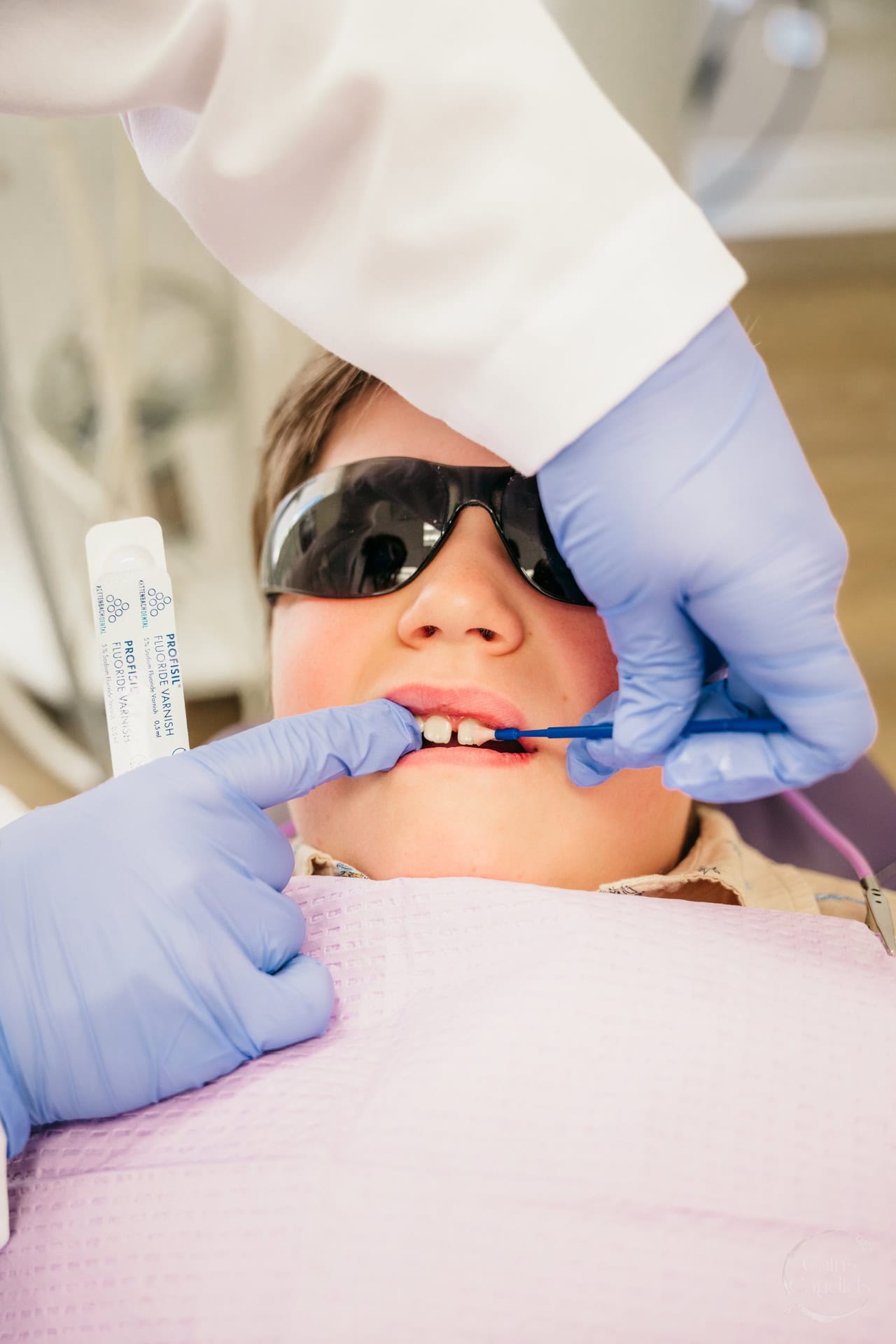 Dental tools with high-quality magnification loupes on a clean workspace